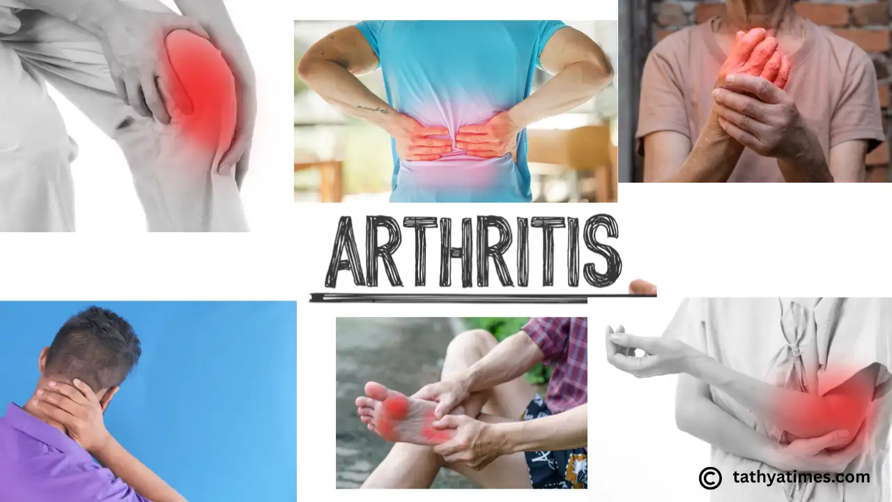 News: युवाओं में बढ़ रही Bone & Joint Problems: Arthritis और Back Pain की चुनौती, जानें कैसे बचें" युवाओं में बढ़ रही Bone & Joint Problems: Arthritis और Back Pain की चुनौती, जानें कैसे बचें